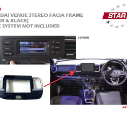    Hyundai Venue Dashboard Stereo Fascia Frame